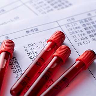 血藥檢測(cè)
